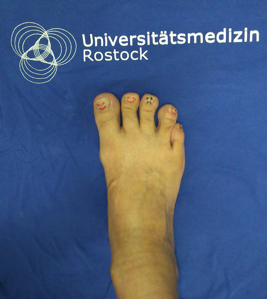 nackter Fuß auf blauem Grund, Endokrinologie der Uniklinik Rostock