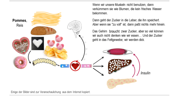 Grafik zur Entstehung von Diabetes, Endokrinologie der Uniklinik Rostock