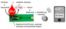Grafik zum Glukose Sensor, Endokrinologie der Uniklinik Rostock